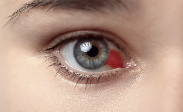 Почему на фотографиях глаза красные? — эффект красных глаз